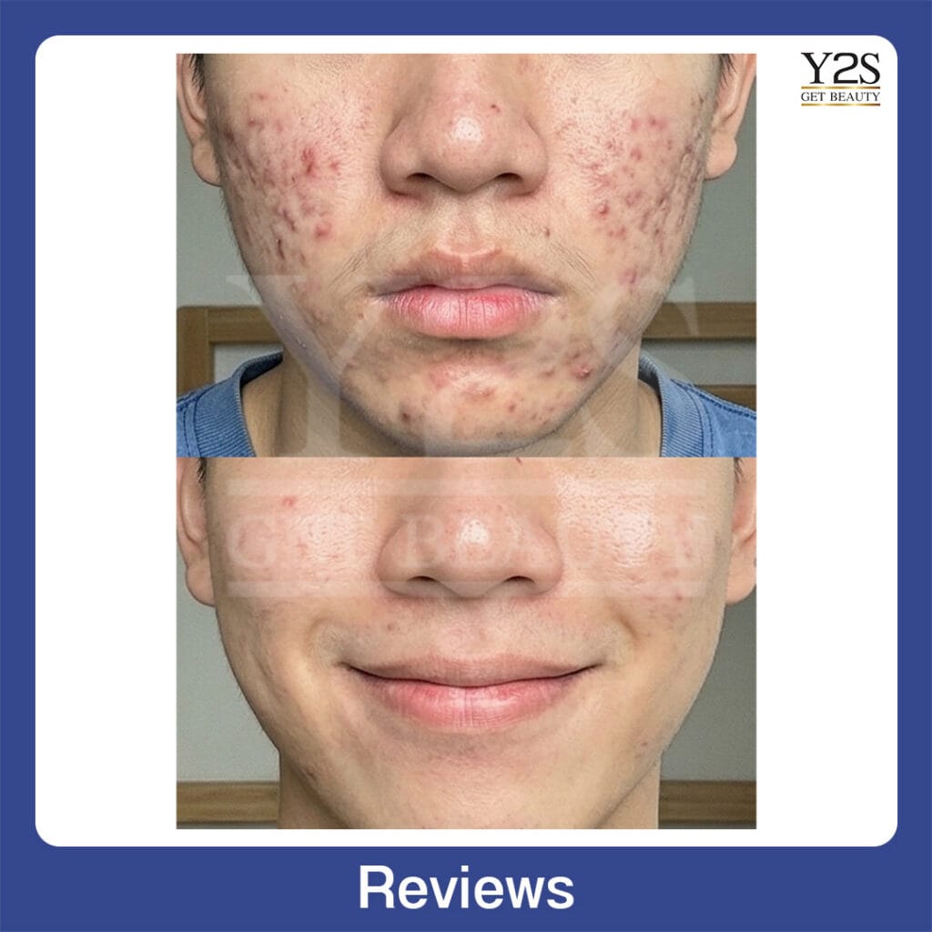 Review25