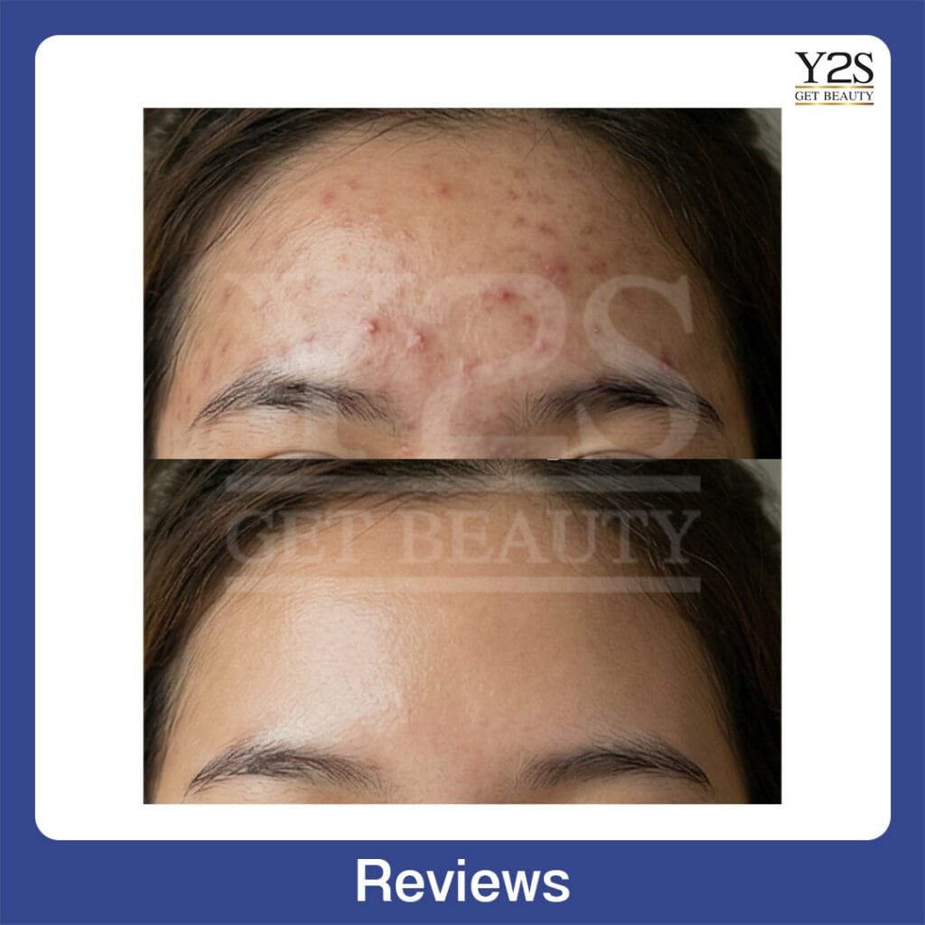 Review26