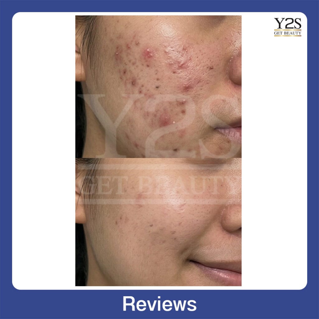 Review27