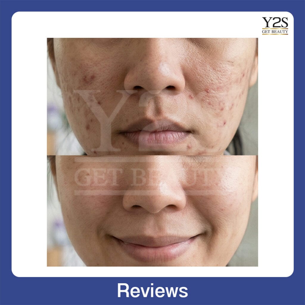 Review28