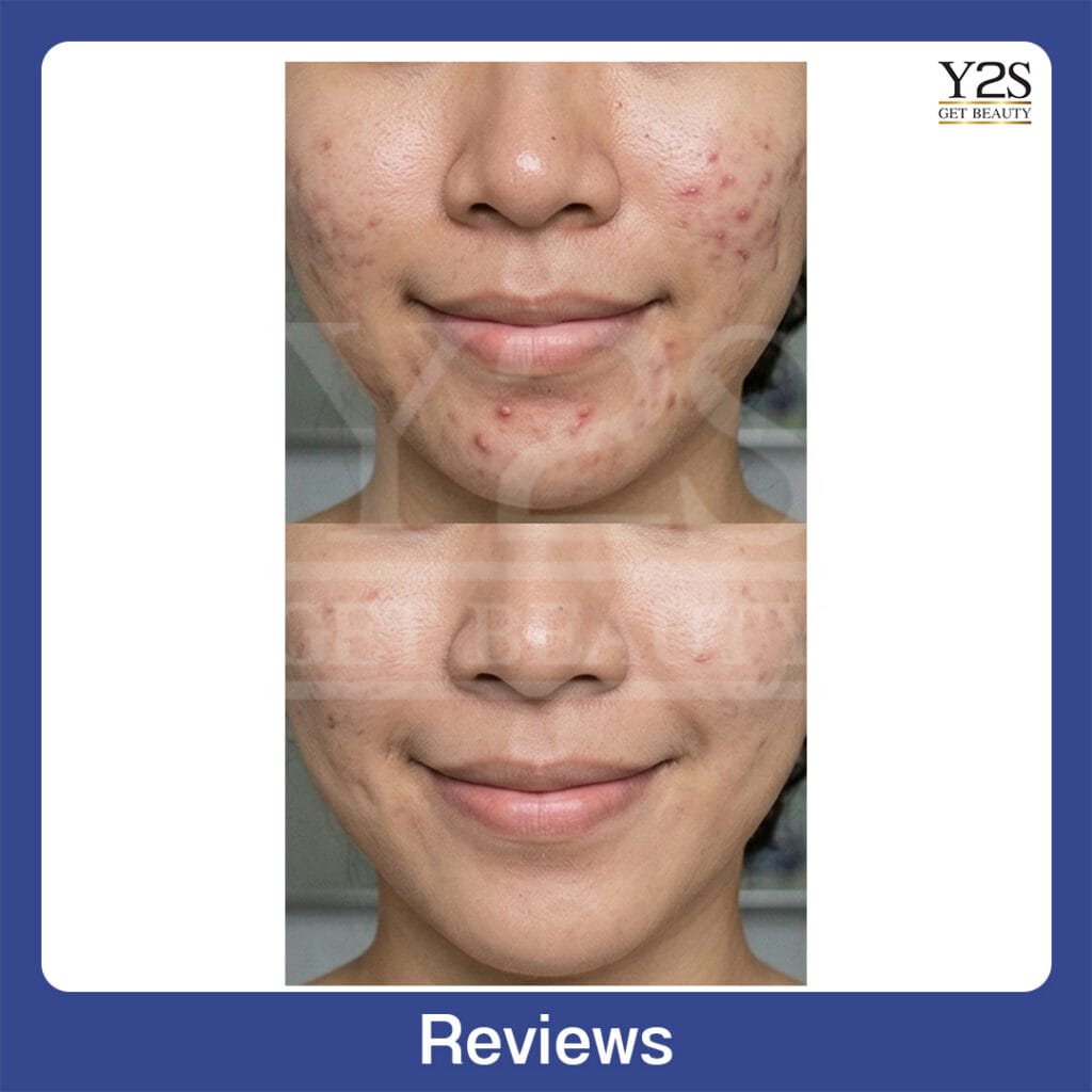 Review29