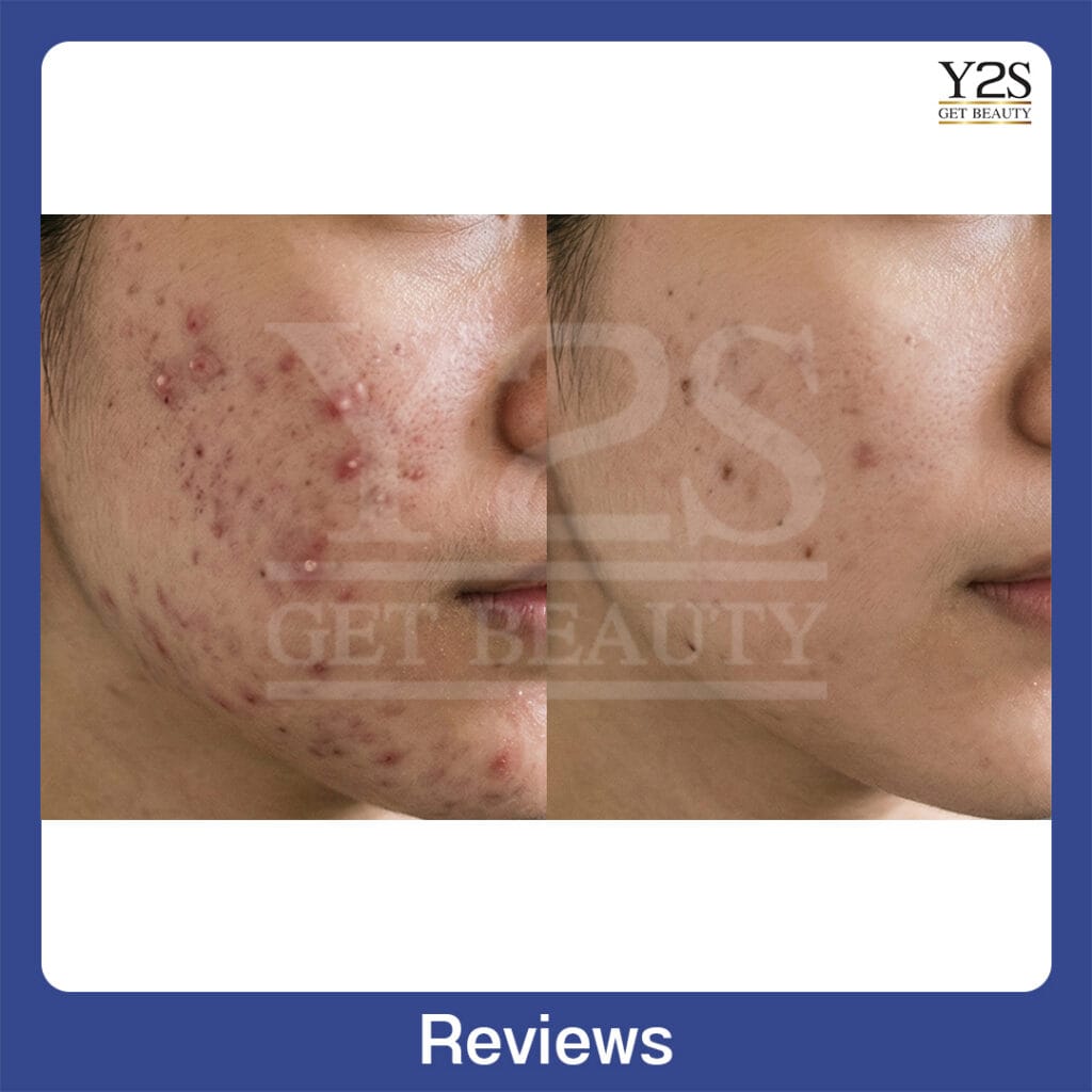 Review30