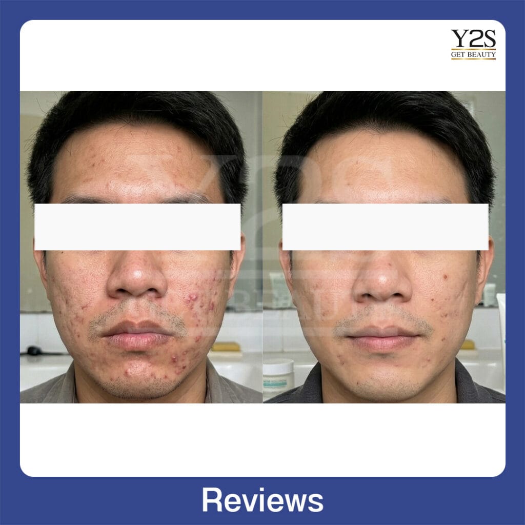 Review33